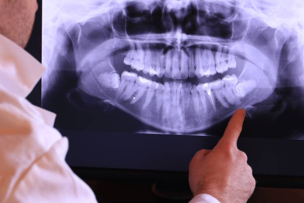 Best Emergency TMJ Treatment in Harbor Hills, OH