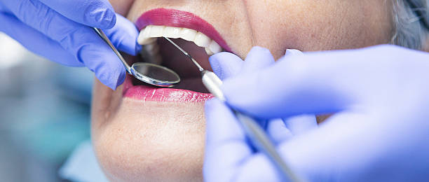 Best Emergency Dental Care for Broken or Chipped Teeth in Harbor Hills, OH