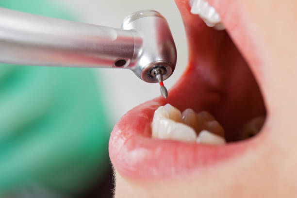 Best Emergency Gum Treatment in Harbor Hills, OH
